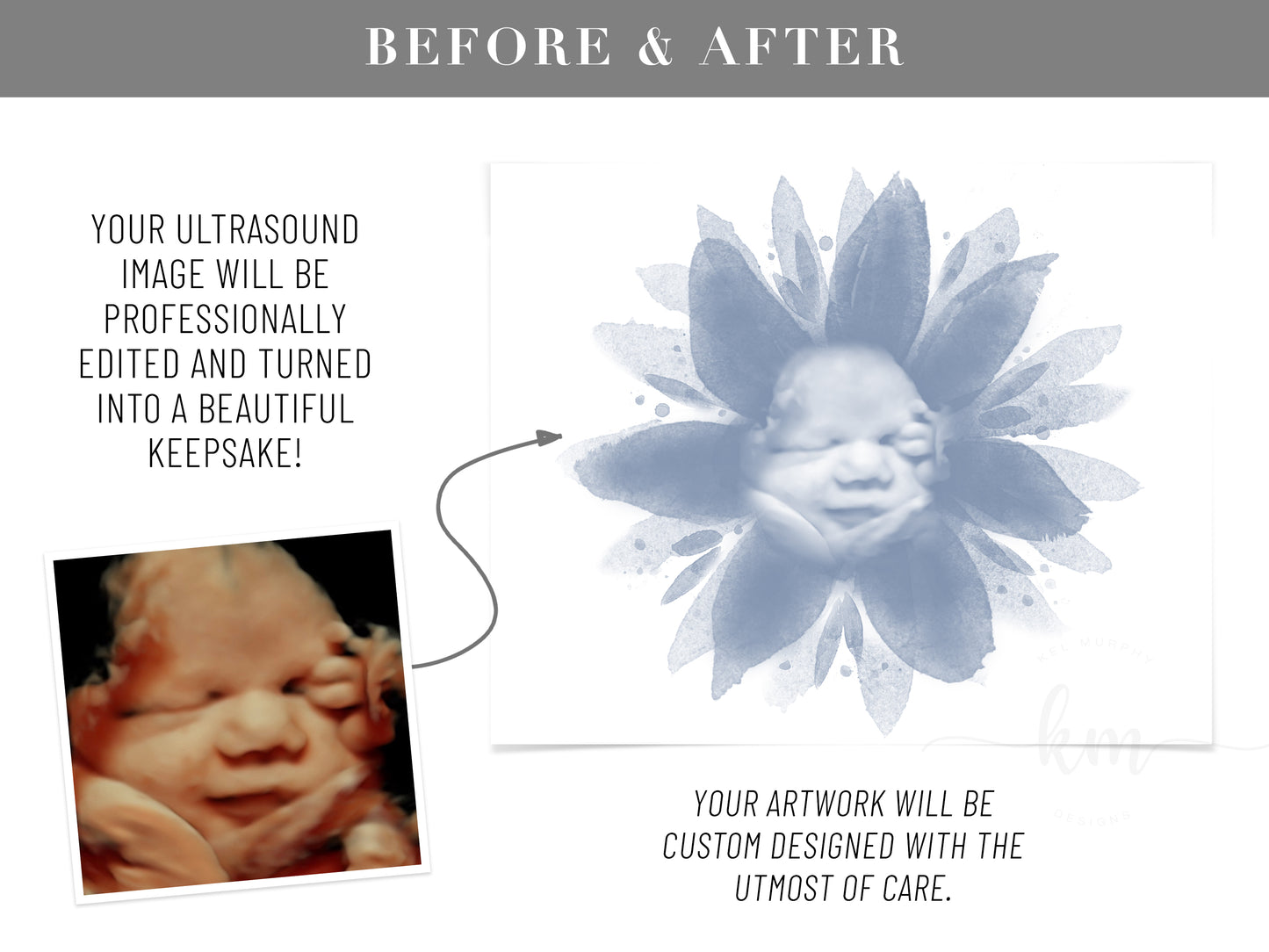 Flower Watercolor 3D Ultrasound Art