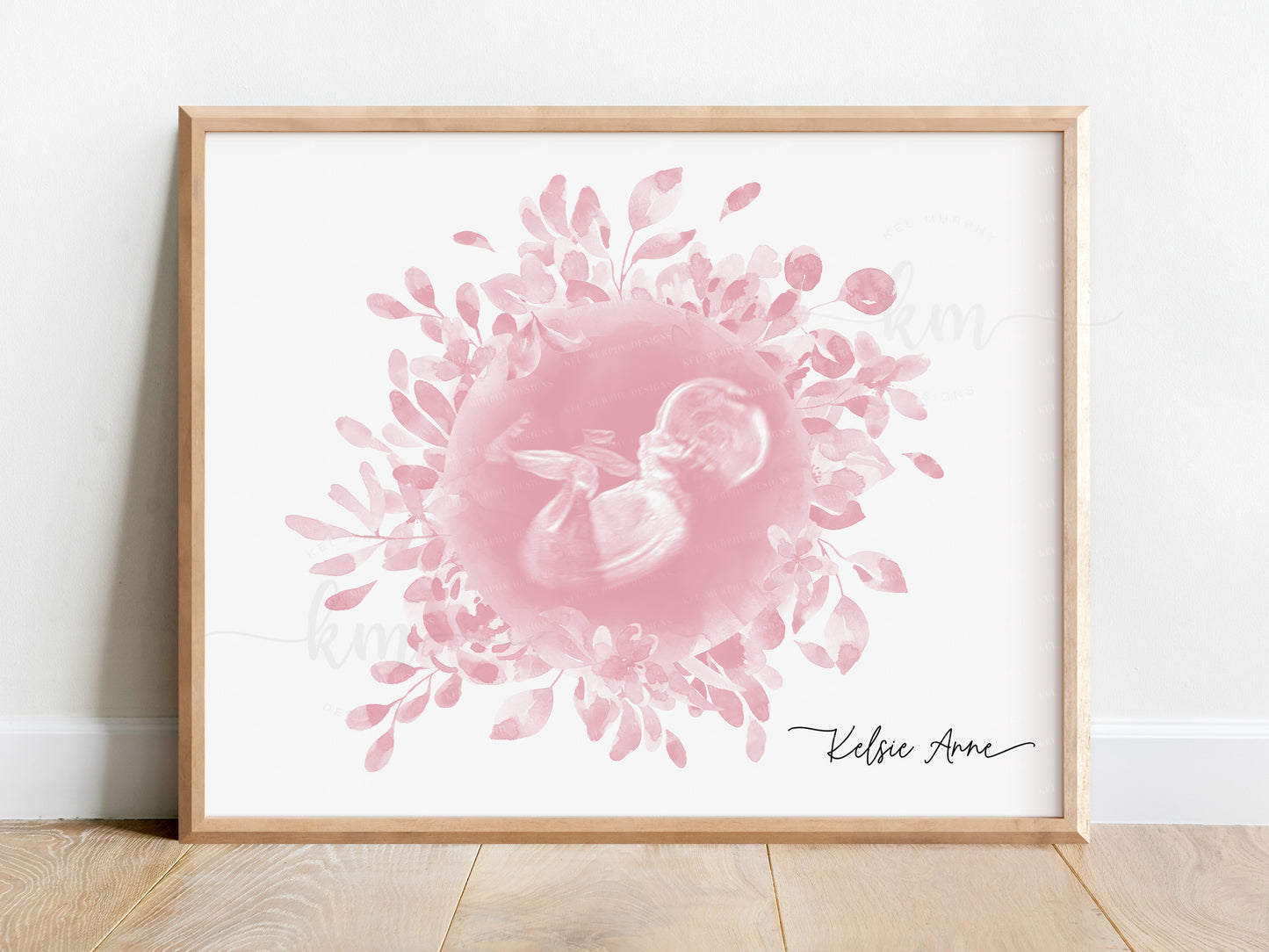 Floral Wreath Watercolor Ultrasound Art