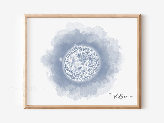 Circle Watercolor IVF Embryo Art