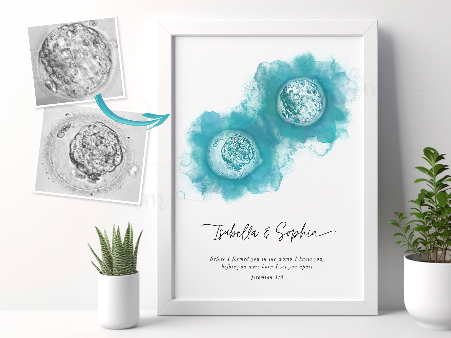 Hand-Painted Watercolor Twins IVF Embryo Art