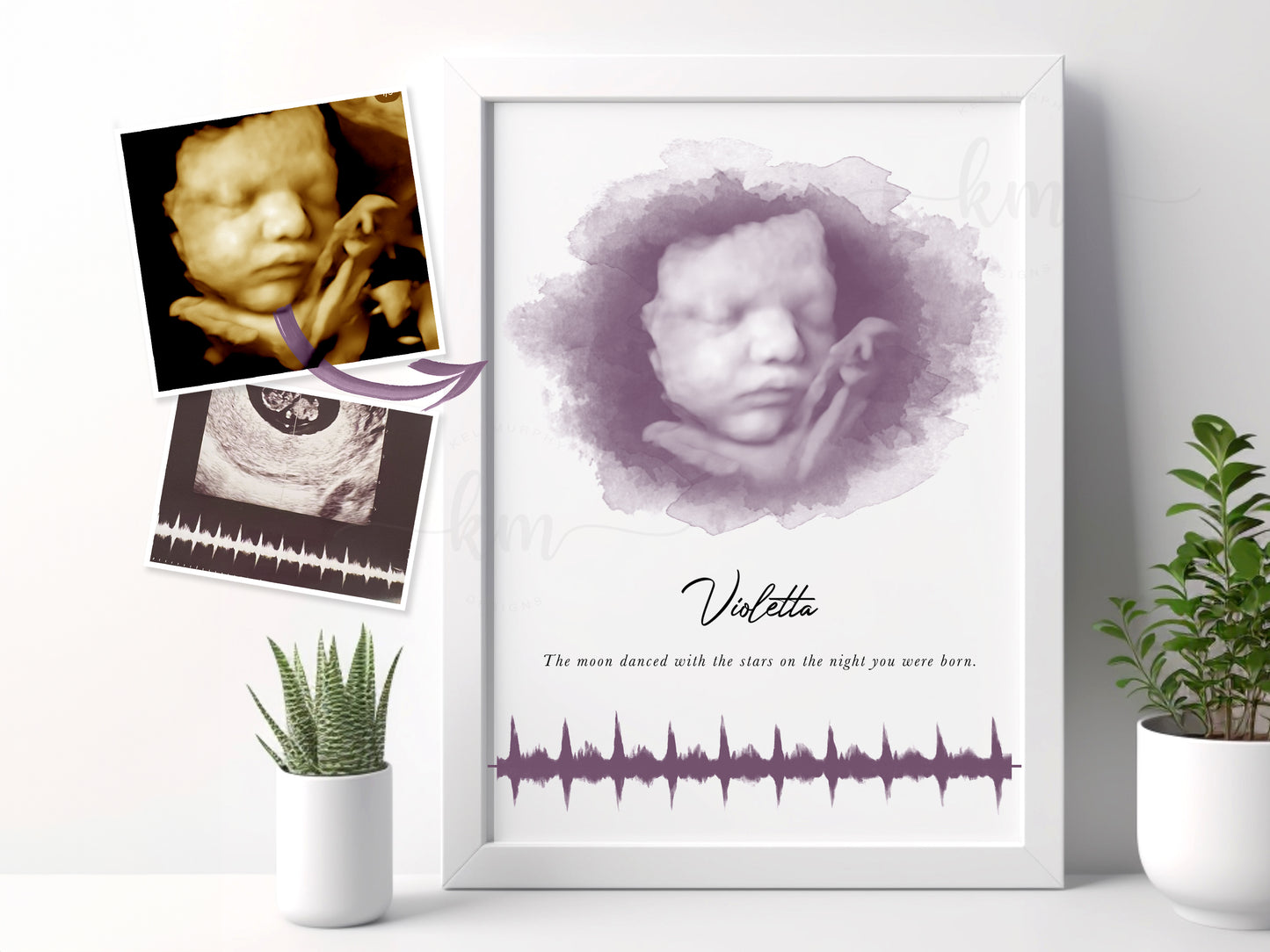 Oval Watercolor 3D Ultrasound Art with Baby Heartbeat