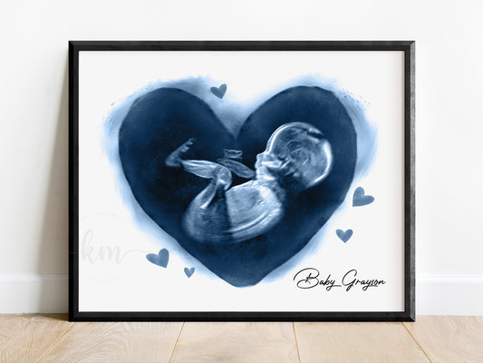 Hearts Pen & Ink Ultrasound Art