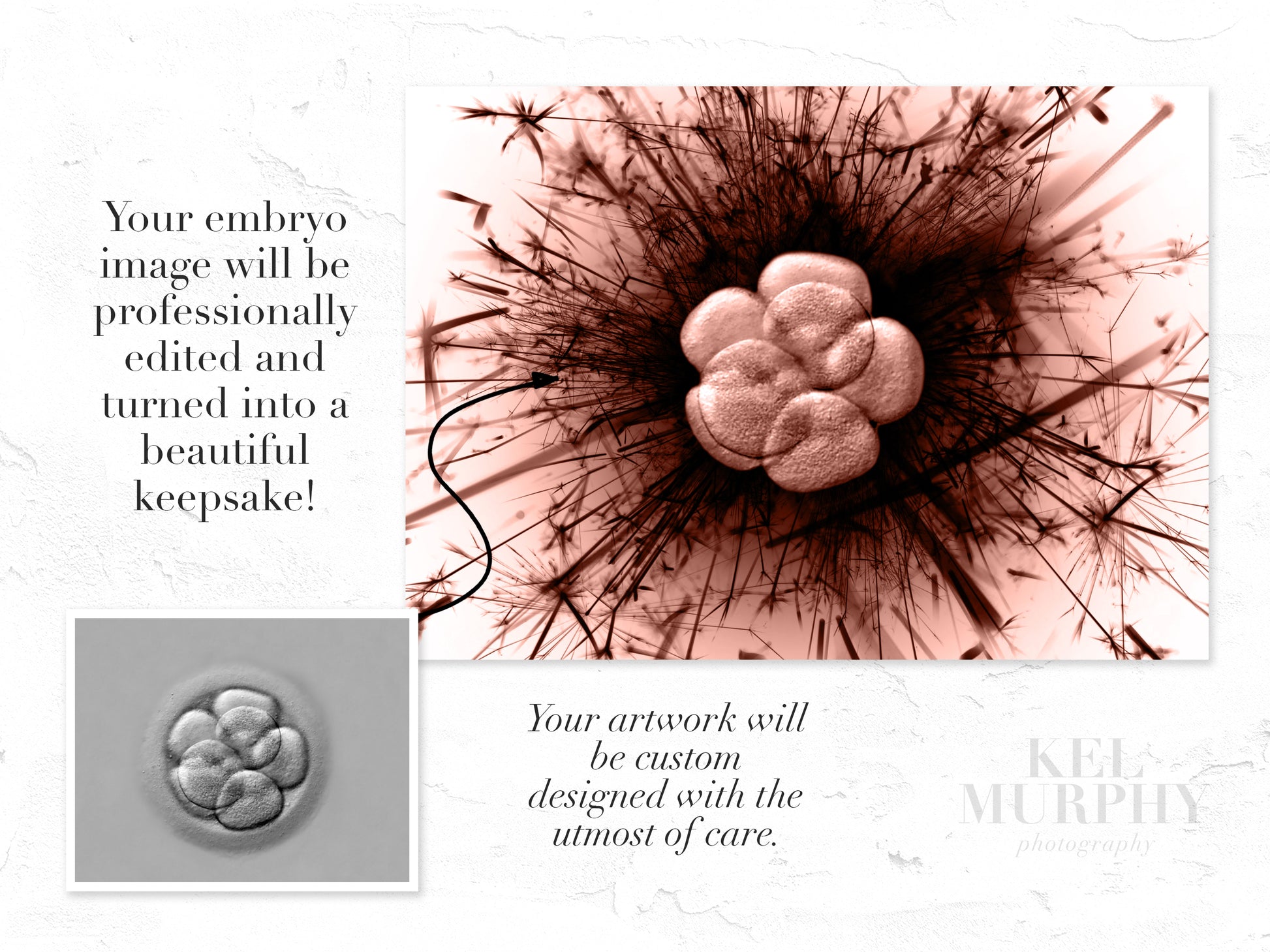 Dandelion wish IVF fertility embryo art print custom before and after