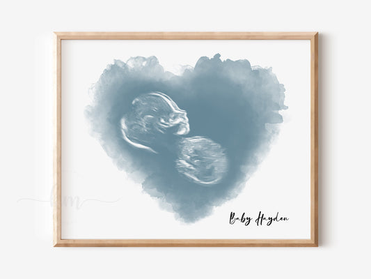 Most popular custom ultrasound art and embryo designs for June Kel Murphy Designs