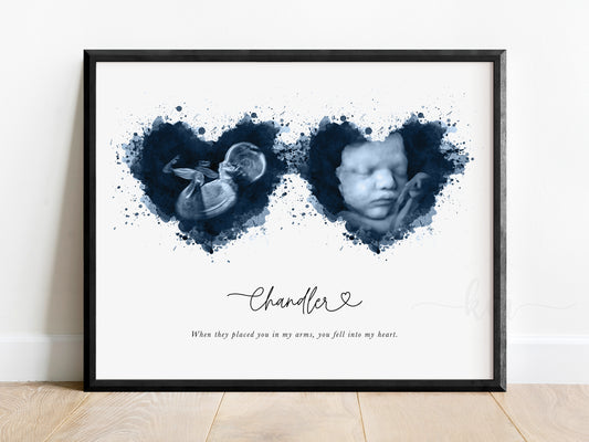 Two Splatter Hearts Pen & Ink Ultrasound Art