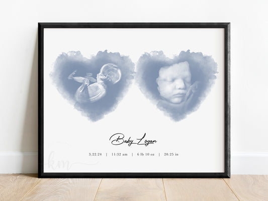 Two Hearts Watercolor Ultrasound Art