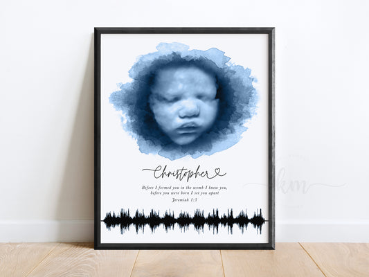 Oval Ultrasound Art with Baby Heartbeat