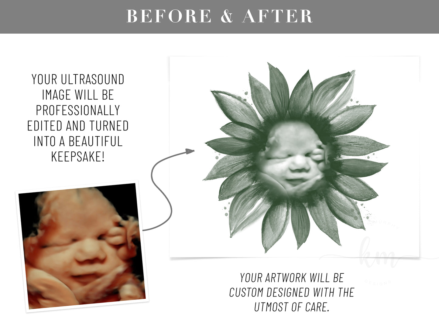 Sunflower Watercolor 3D Ultrasound Art