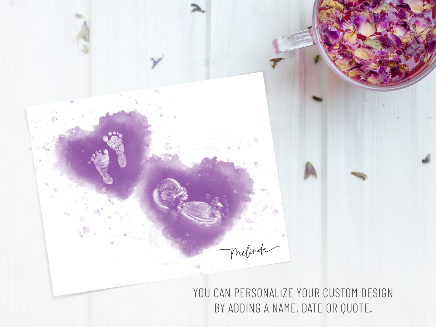 Baby Footprint Art with Watercolored Ultrasound Heart