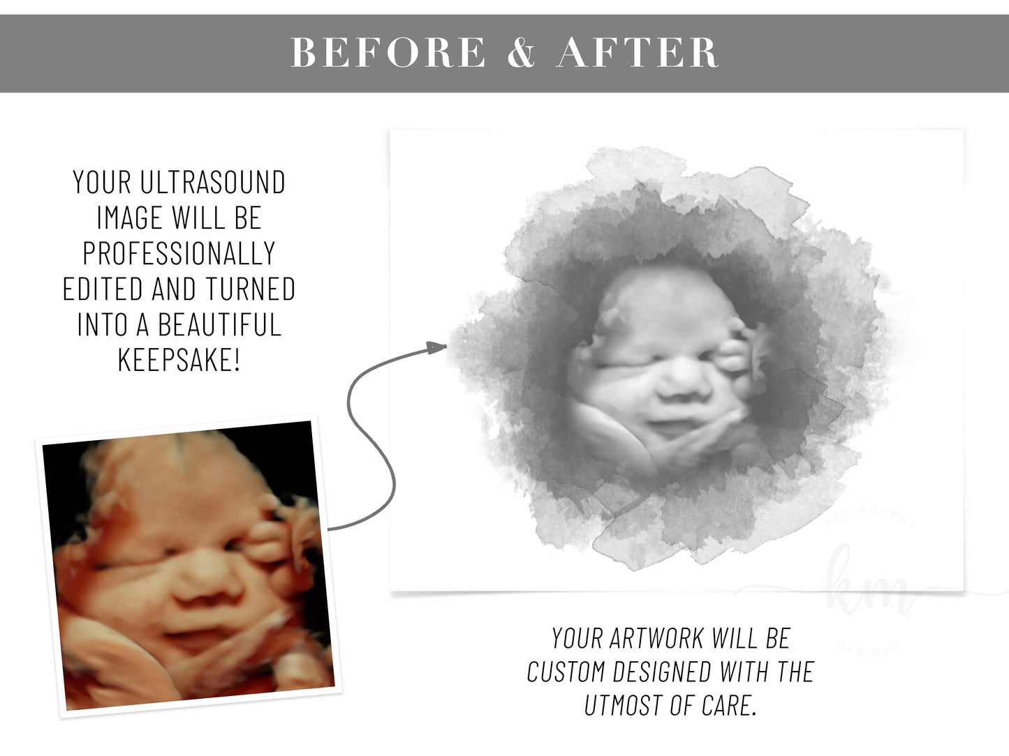 Baby Shower Guestbook Art with Ultrasound