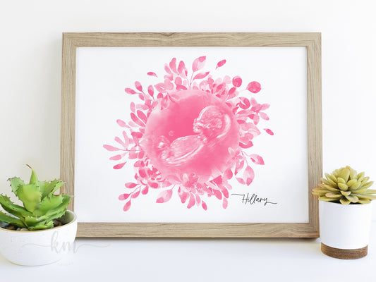 Floral Wreath Watercolor Ultrasound Art