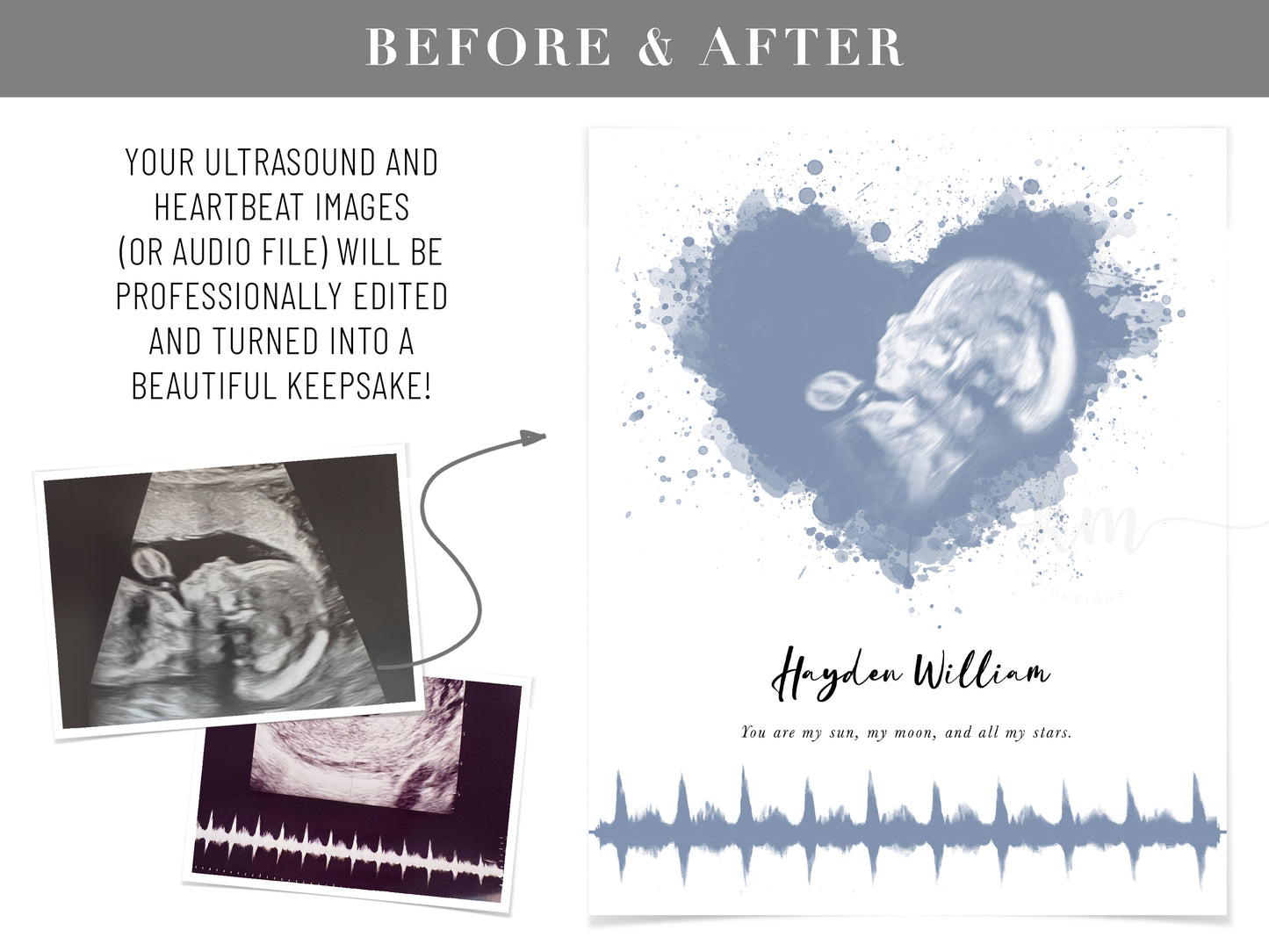 Splatter Heart Watercolor Ultrasound Art with Baby Heartbeat