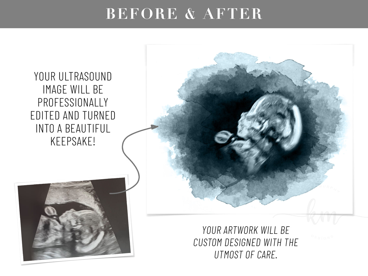 Oval Ultrasound Art