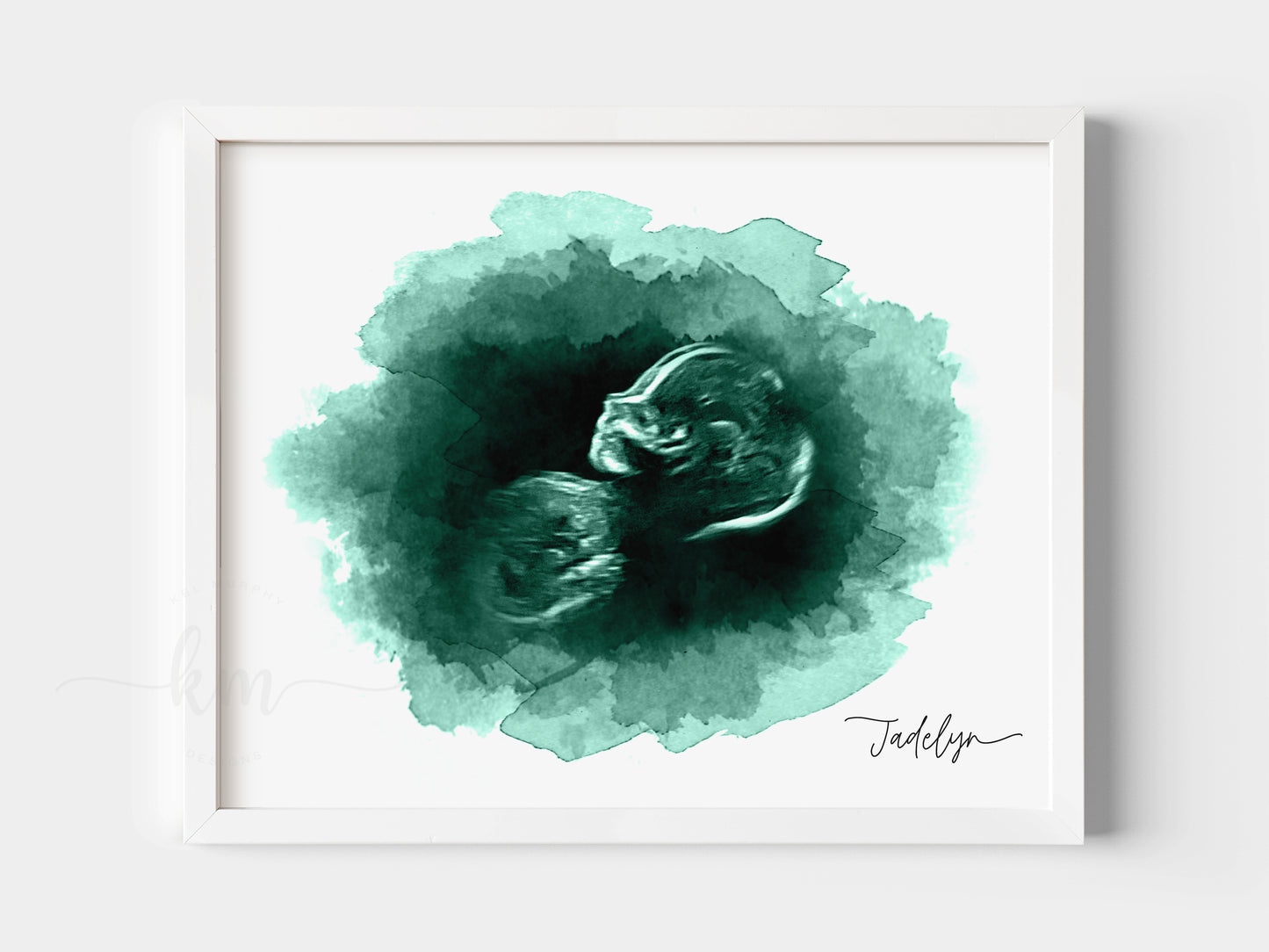 Oval Ultrasound Art