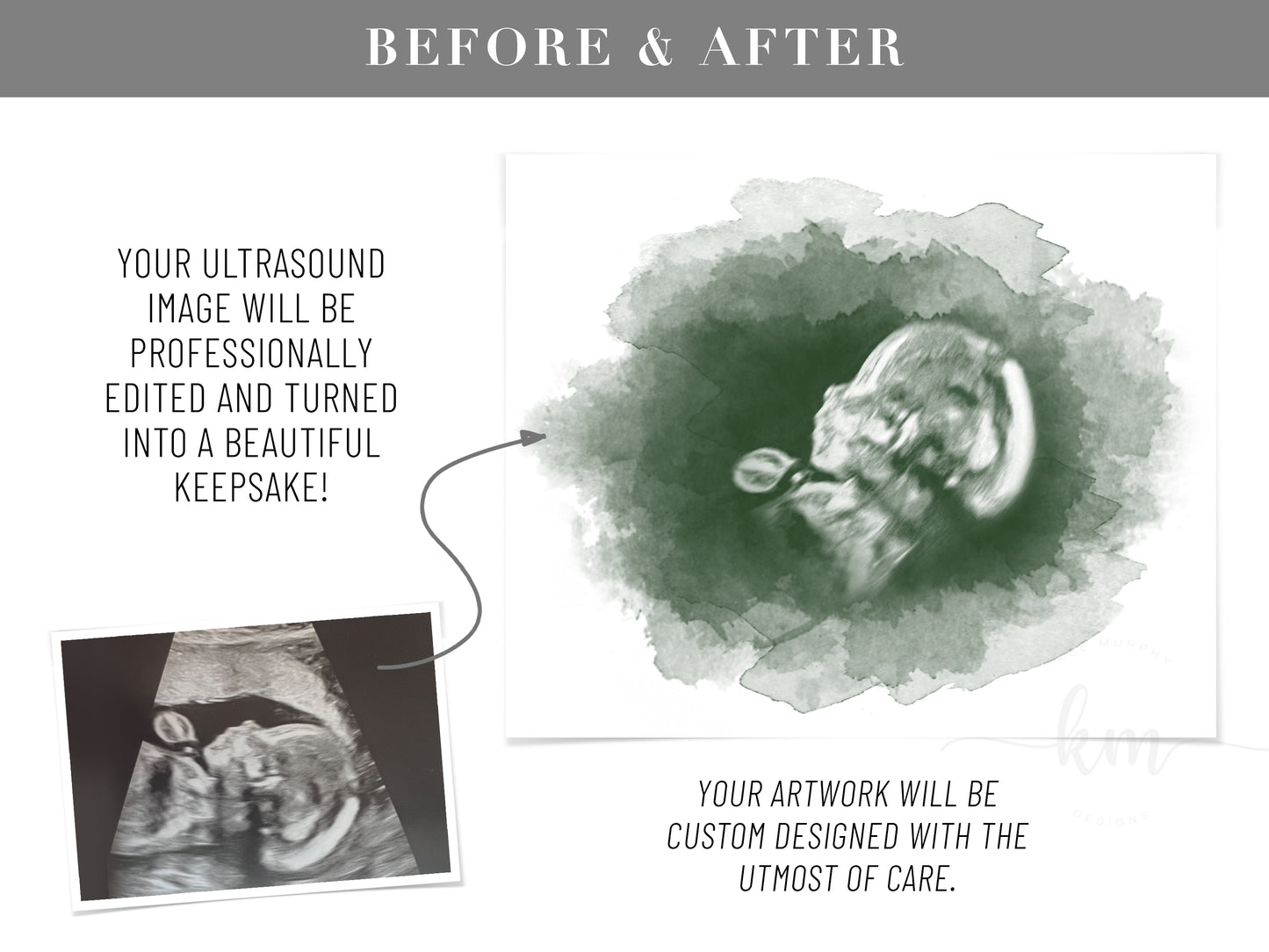 Oval Watercolor Ultrasound Art