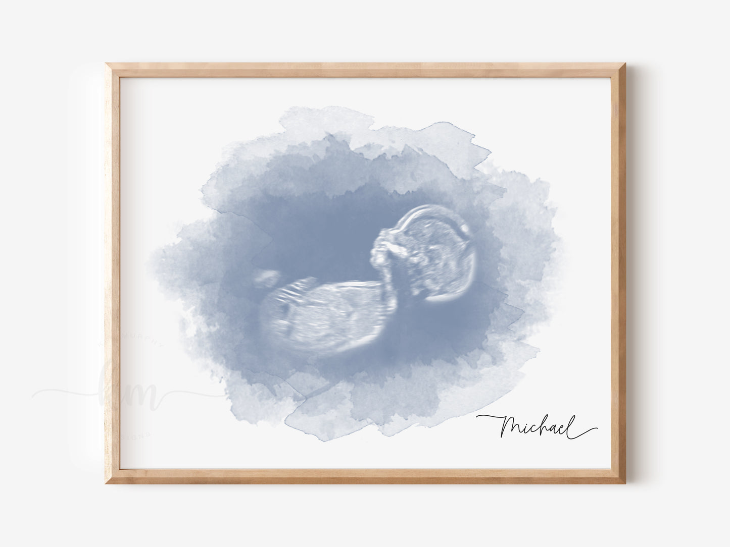 Oval Watercolor Ultrasound Art