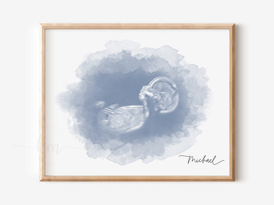Oval Watercolor Ultrasound Art