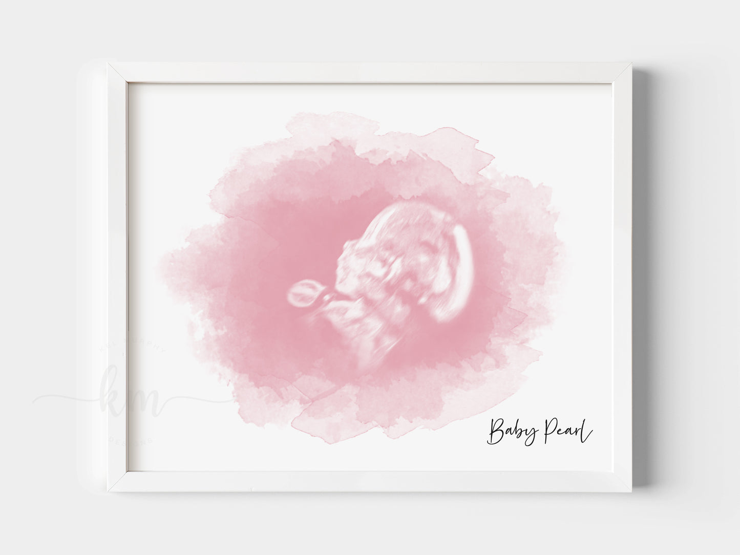 Oval Watercolor Ultrasound Art