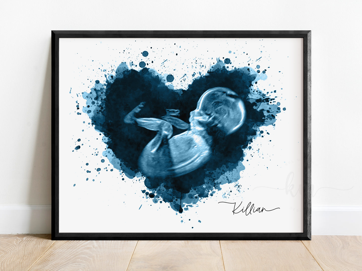 Splatter Heart Ultrasound Art