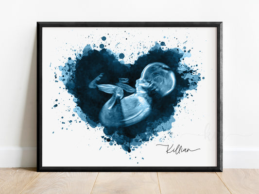 Splatter Heart Ultrasound Art