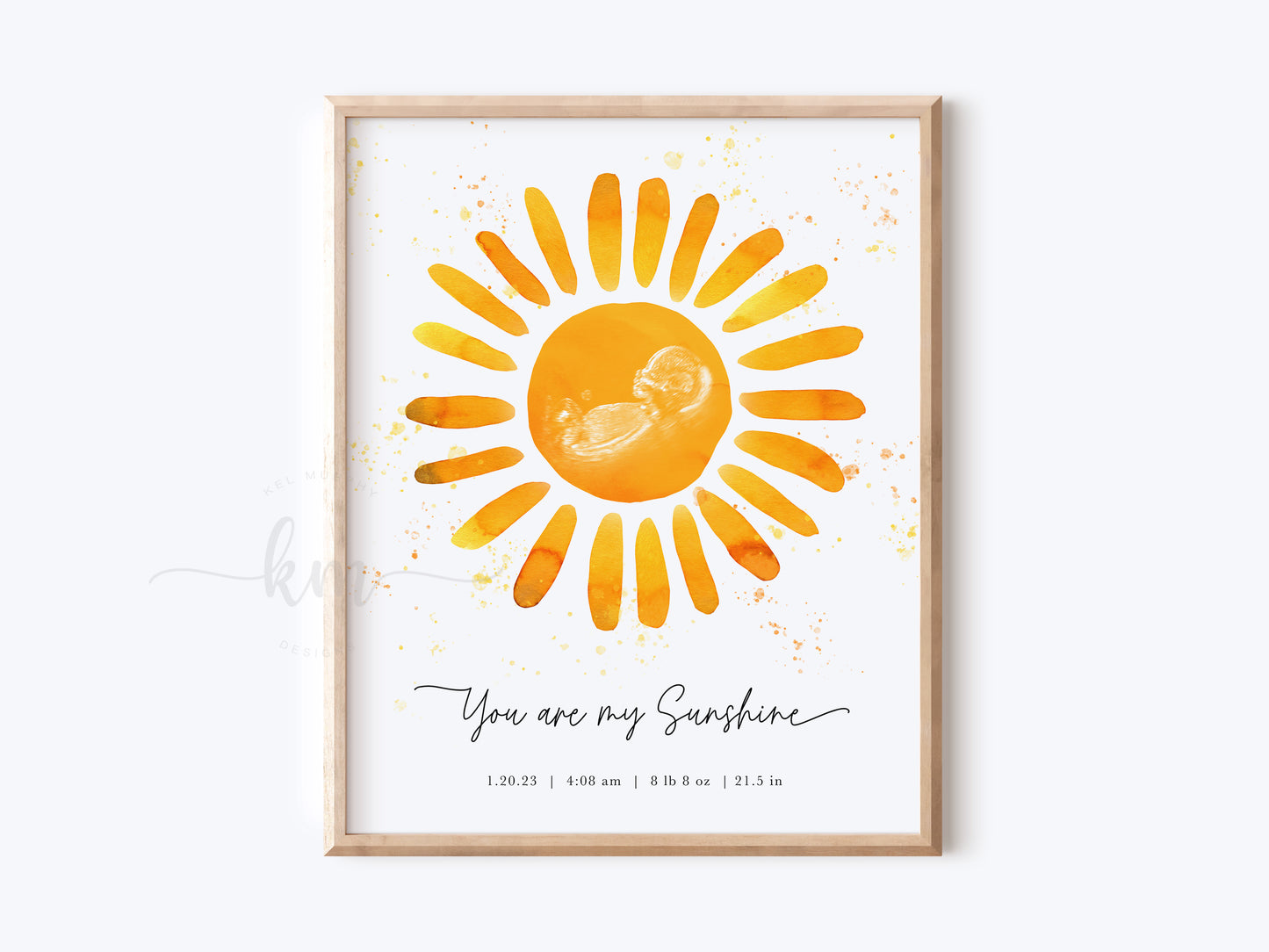 You Are My Sunshine Watercolor Ultrasound Art