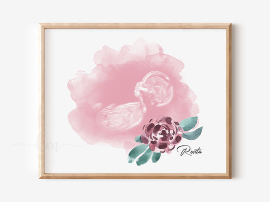 Flower Watercolor Ultrasound Art
