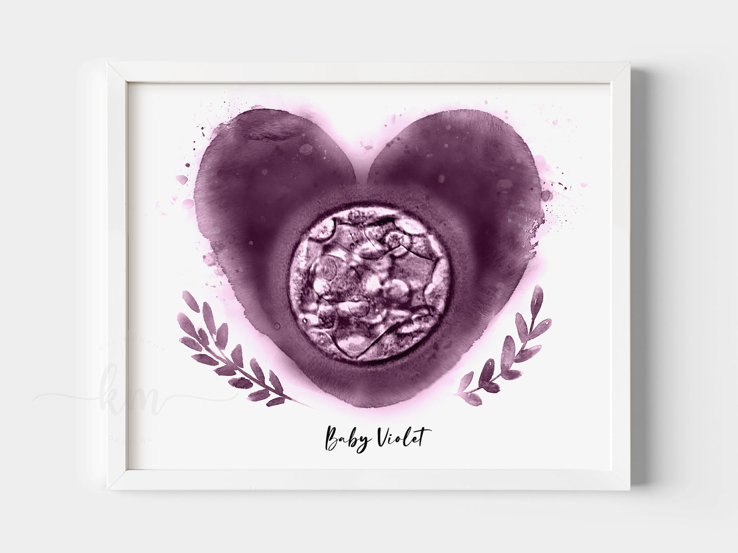 Heart with Branches Watercolor IVF Embryo Art