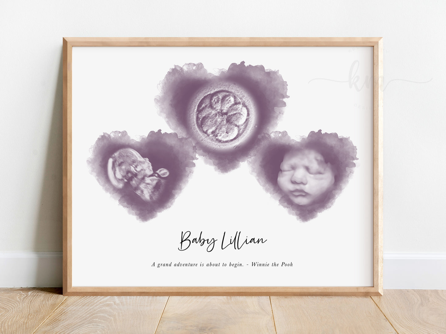 Three Hearts Pyramid Watercolor IVF Embryo & Ultrasound Art