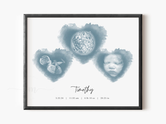 Three Hearts Pyramid Watercolor IVF Embryo & Ultrasound Art