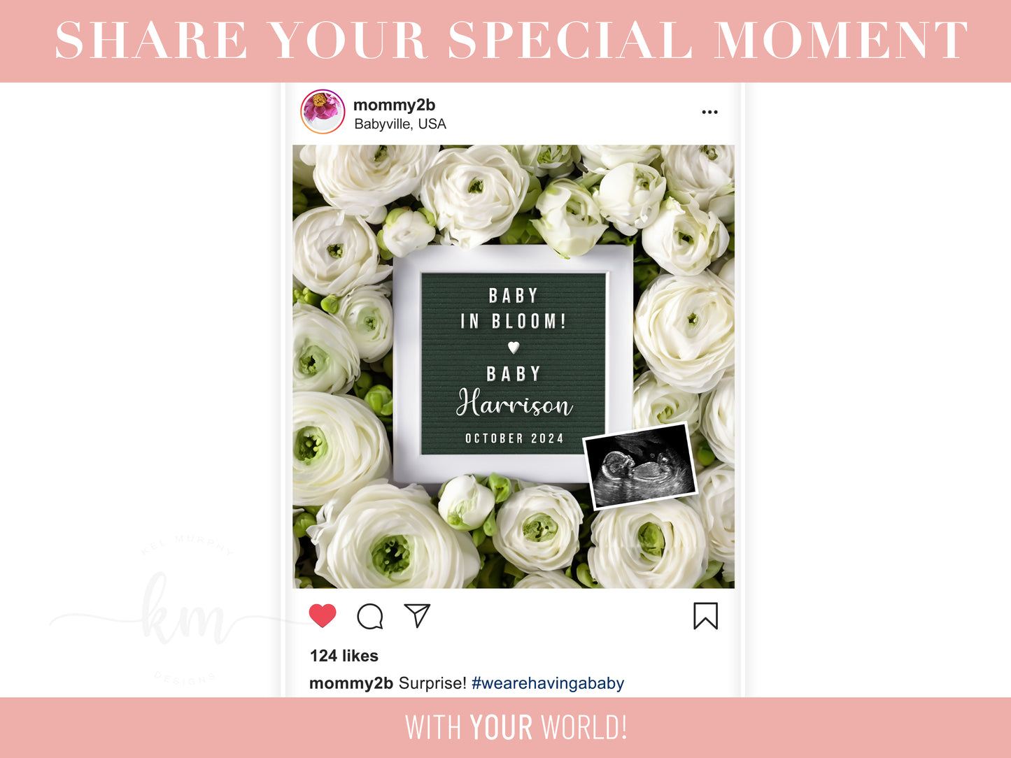 White Ranunculus Flowers Digital Pregnancy Announcement
