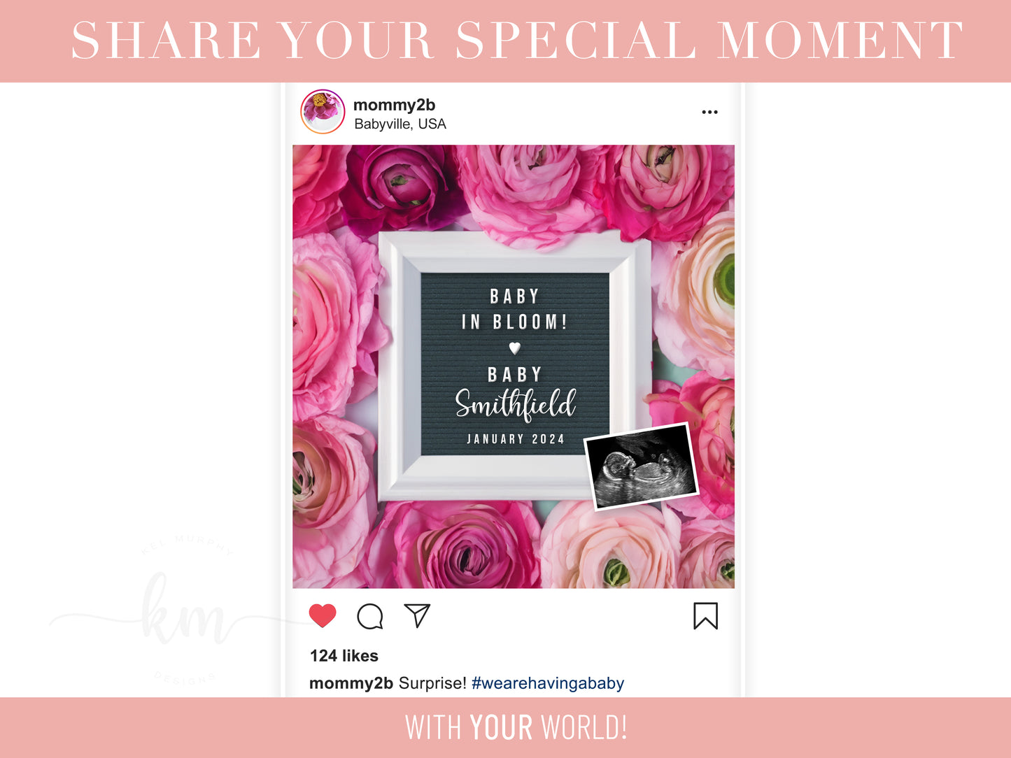 Ranunculus Flowers Digital Pregnancy Announcement
