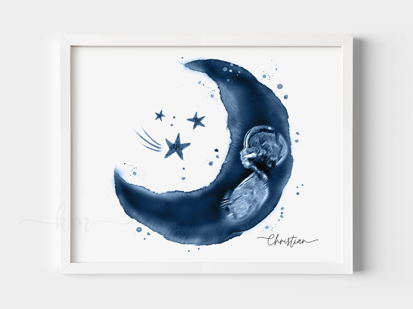 Moon and Stars Pen & Ink Ultrasound Art