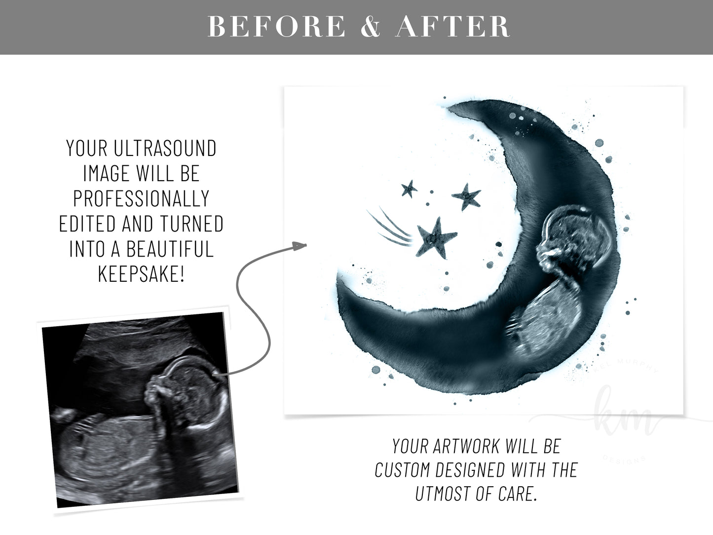 Baby Shower Guestbook Art with Moon Pen & Ink Ultrasound