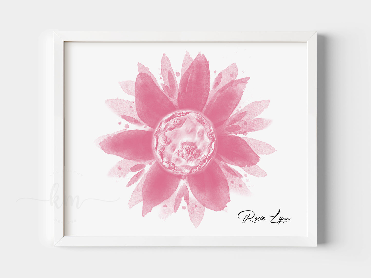 Flower Watercolor IVF Embryo Art