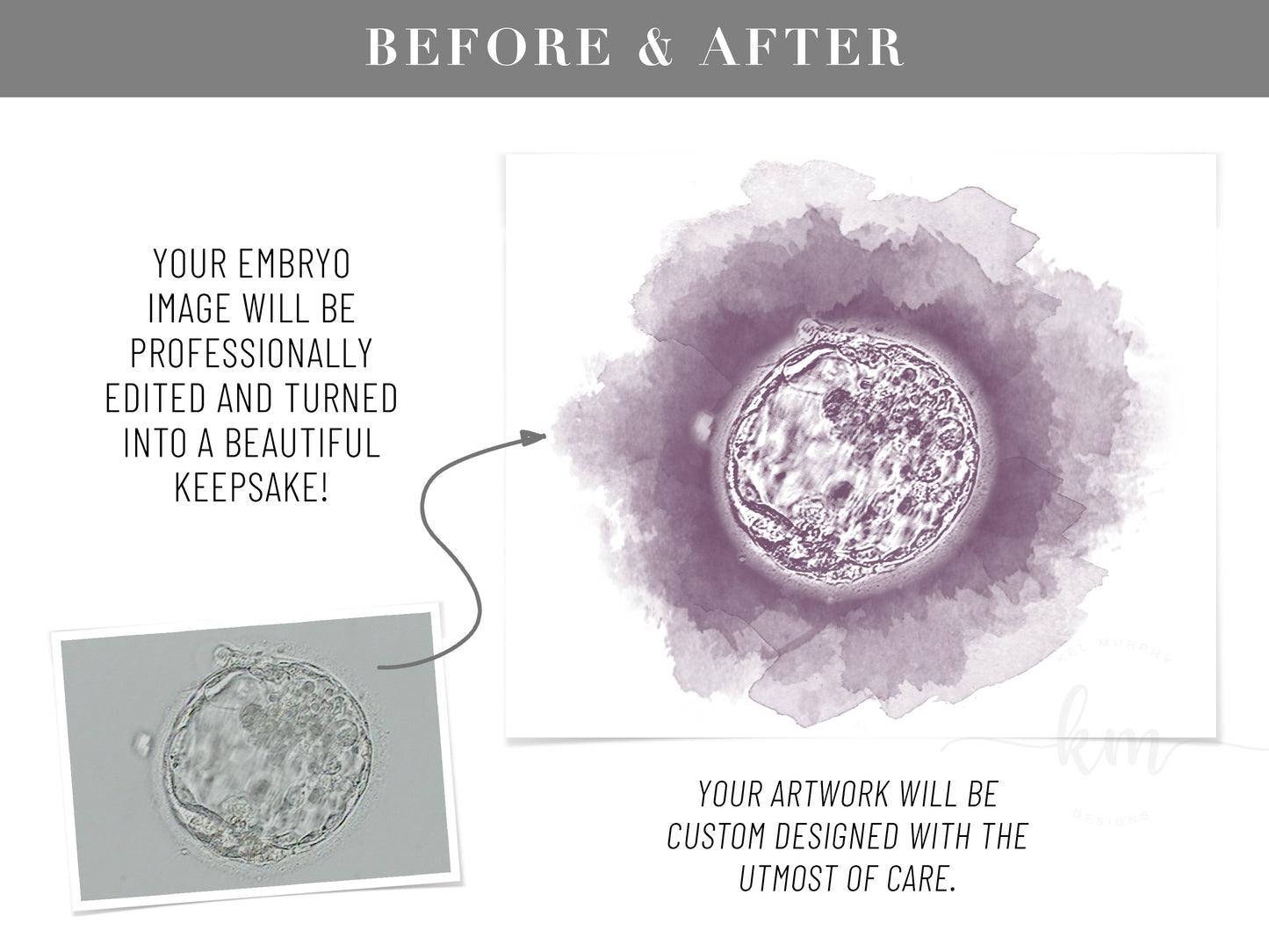 Circle Watercolor IVF Embryo Art