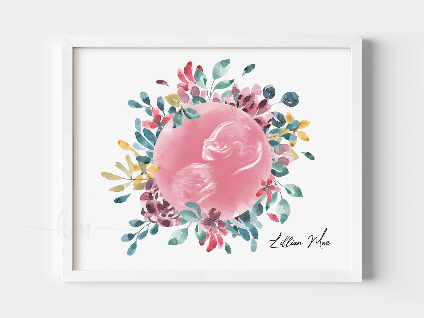 Flower Wreath Watercolor Ultrasound Art