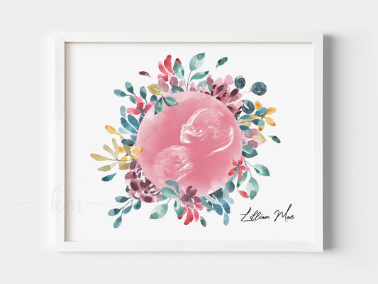 Flower Wreath Watercolor Ultrasound Art