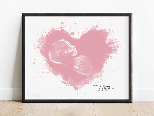 Splatter Heart Watercolor Ultrasound Art