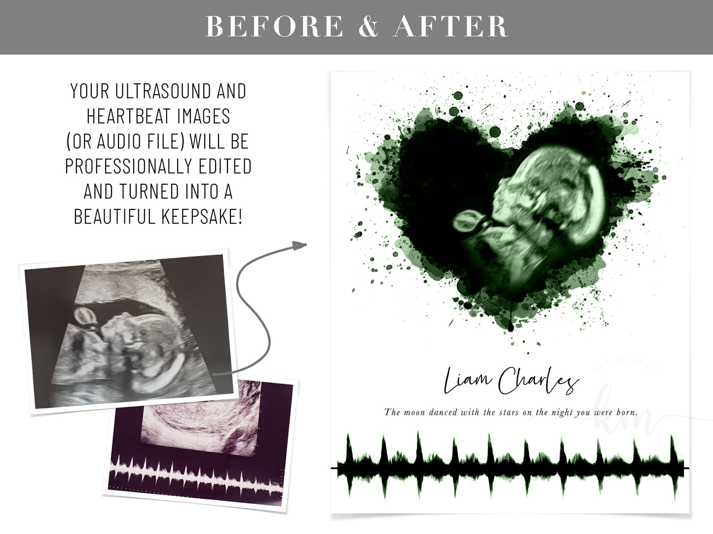 Splatter Heart Pen & Ink Ultrasound Art with Baby Heartbeat