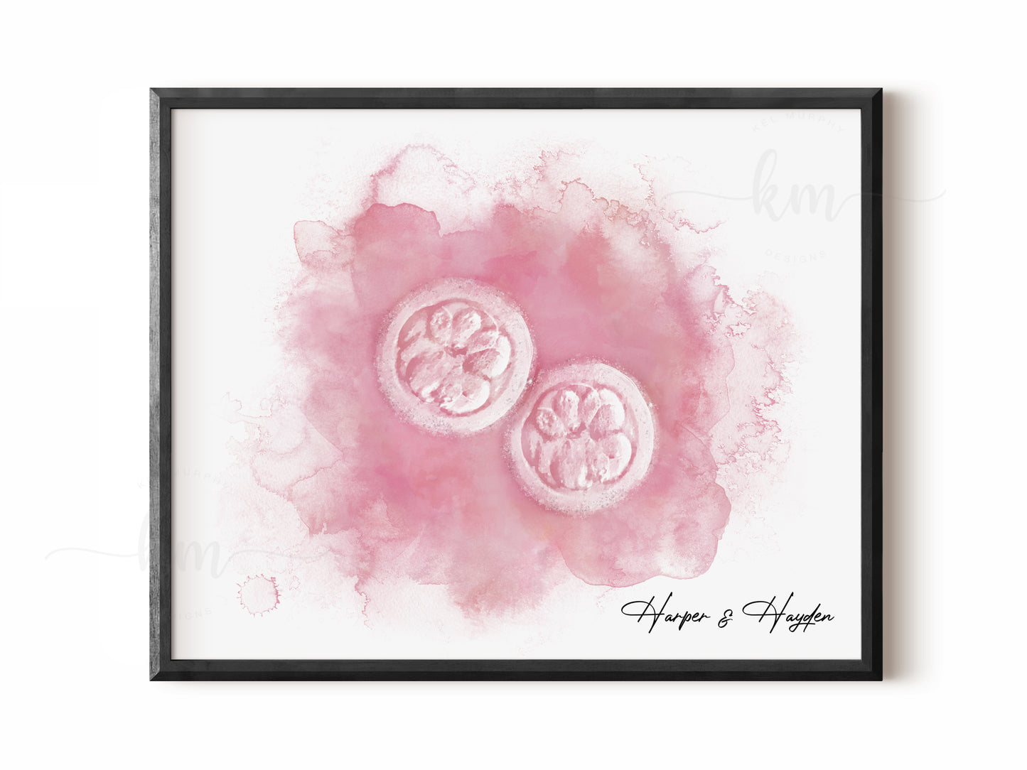 Hand-Painted Watercolor IVF Embryo Art