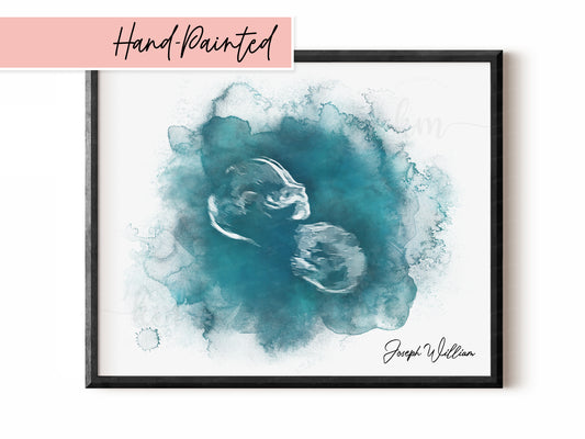 Hand-Painted Watercolor Ultrasound Art