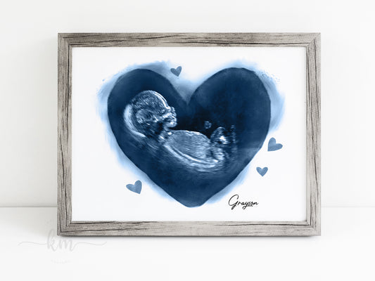 Hearts Pen & Ink Ultrasound Art