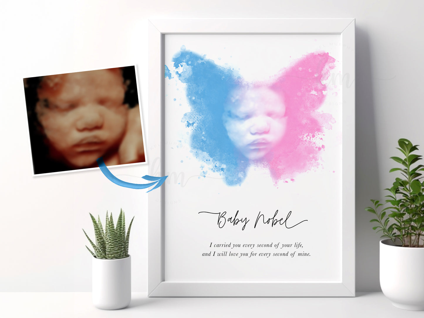 Butterfly Watercolor 3D Ultrasound Art