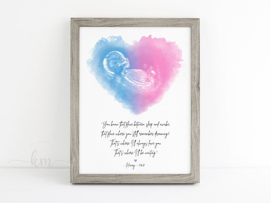 Infant Loss Heart Watercolor Ultrasound Art with Quote (Vertical)