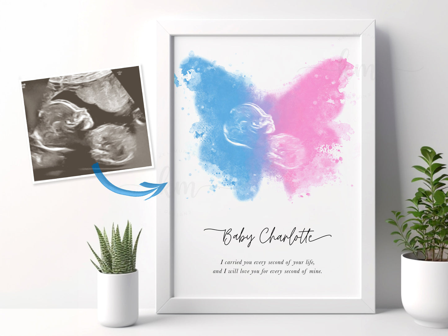 Butterfly Watercolor Ultrasound Art (Vertical)