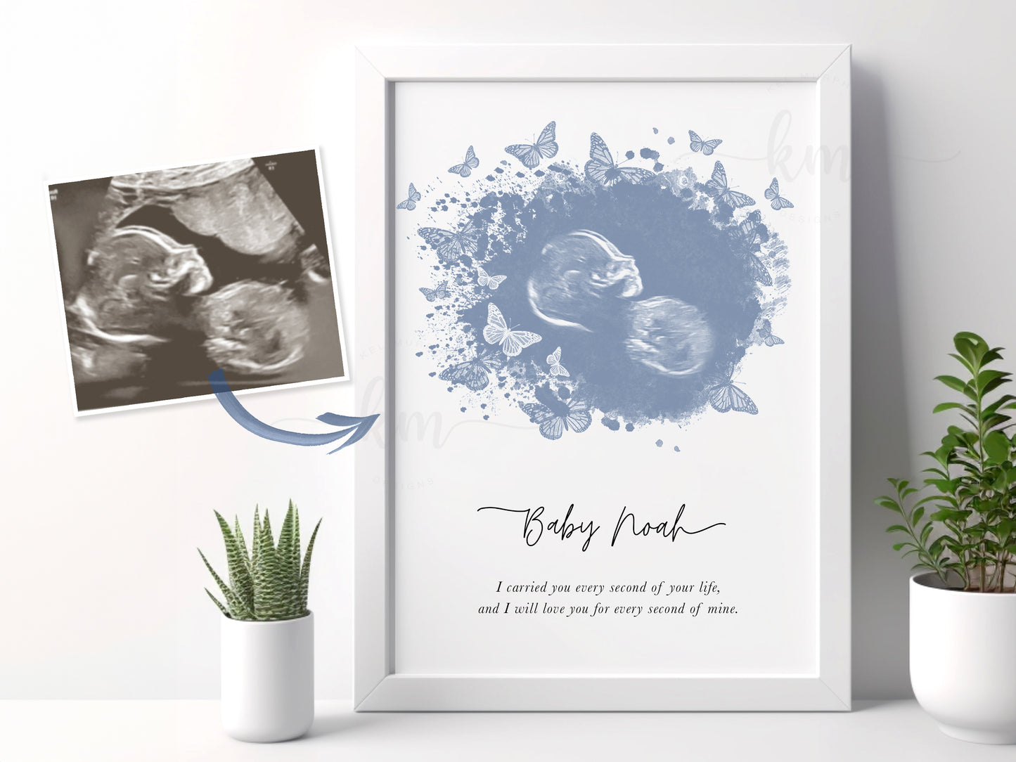 Butterflies Watercolor Ultrasound Art