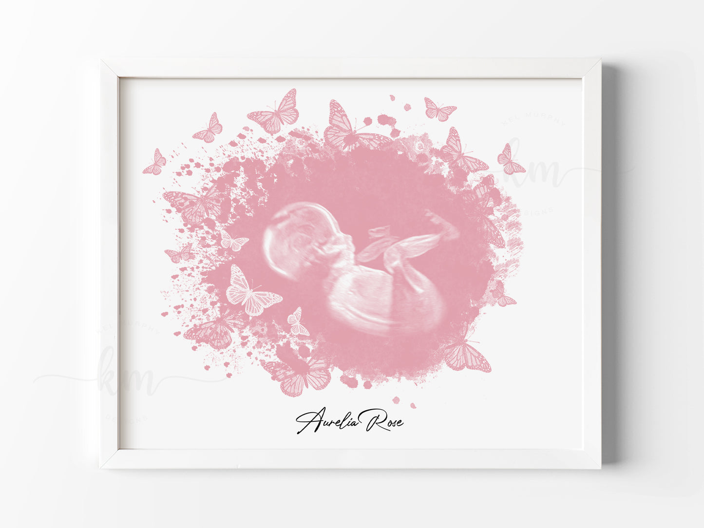 Butterflies Watercolor Ultrasound Art