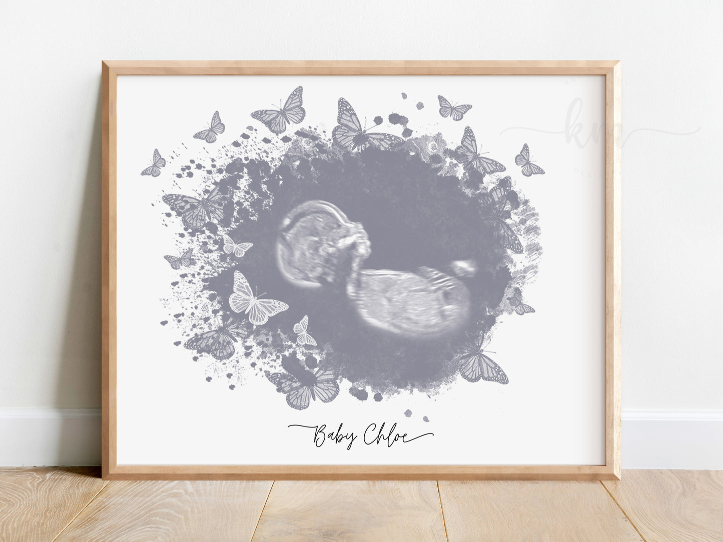 Butterflies Watercolor Ultrasound Art