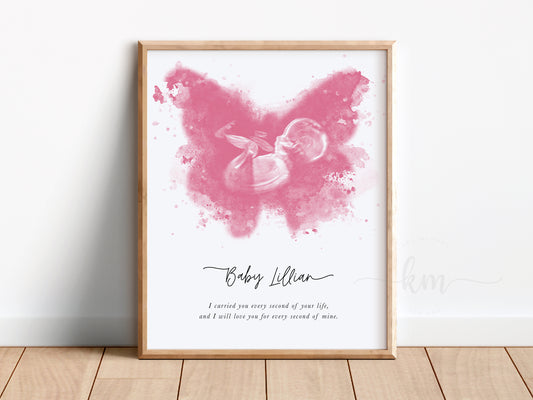 Butterfly Watercolor Ultrasound Art (Vertical)
