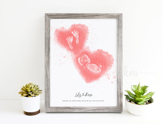 Baby Footprint Art with Watercolor Ultrasound Heart (Vertical)